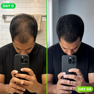 Ceyla - Men's Hair Growth Shampoo Bar