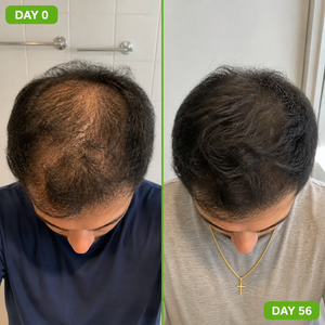 Ceyla - Men's Hair Growth Shampoo Bar