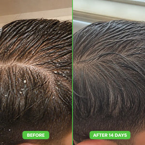 Ceyla - Men's Hair Growth Shampoo Bar
